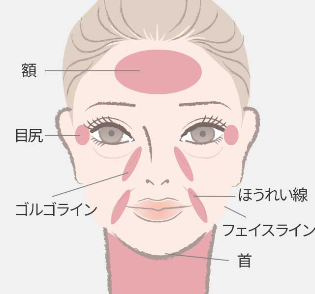  顔全体のリフトアップ